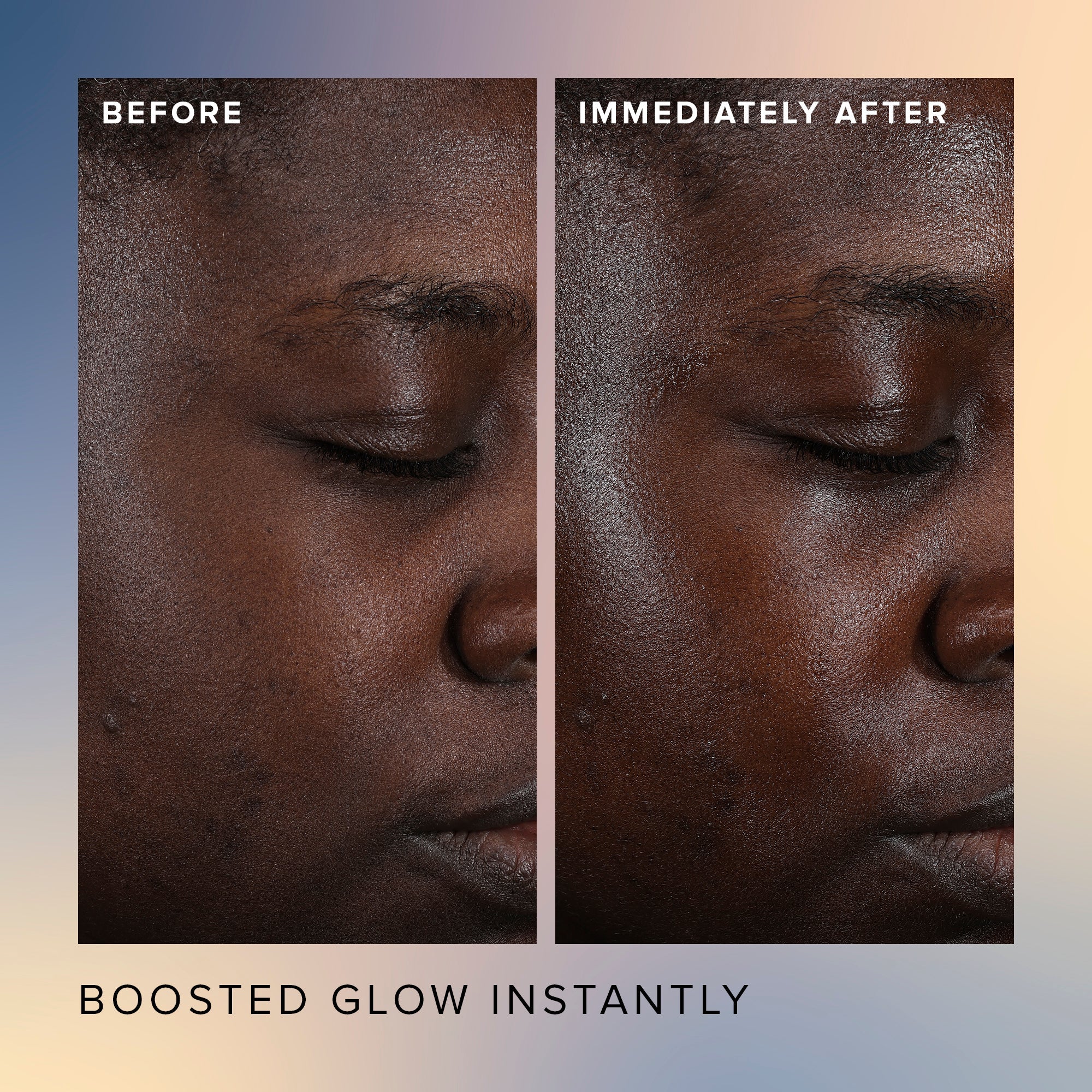 Honey Glow 17% AHA + BHA Resurfacing Acid Serum - Image 5